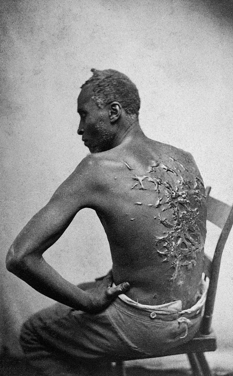 The Scourged Back